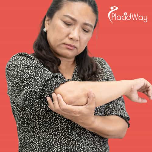 Non-Surgical Elbow Pain Relief: Singaporeans Are Flocking to Osaka for Stem Cell Therapy